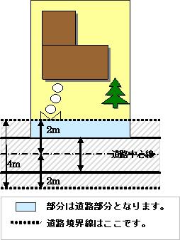 中心後退についての図解