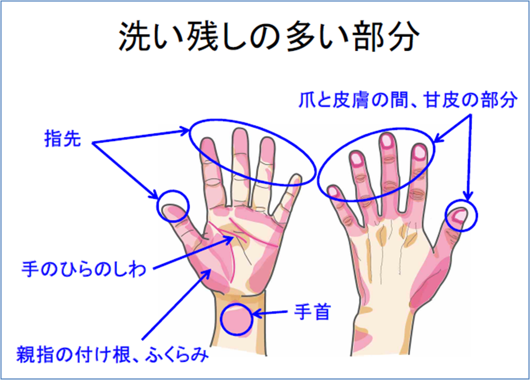 洗い残しの多い部分